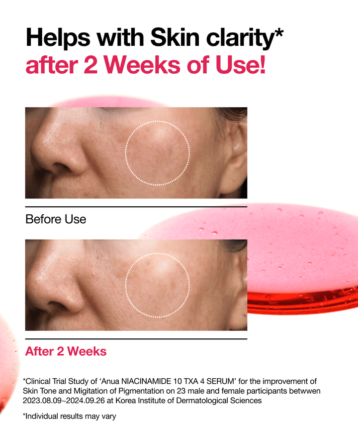 Anua Niacinamide 10% + TXA 4% Serum LuxeDew