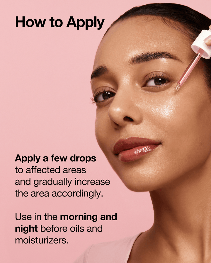 Anua Niacinamide 10% + TXA 4% Serum LuxeDew
